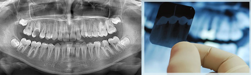 oral-diagnoz